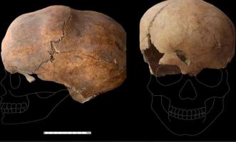 Discovered 6,000-Year-Old Shaped Skull from Late Neolithic