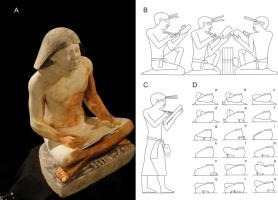 In the Ancient Egypt the Scribes were victims of workplace diseases!