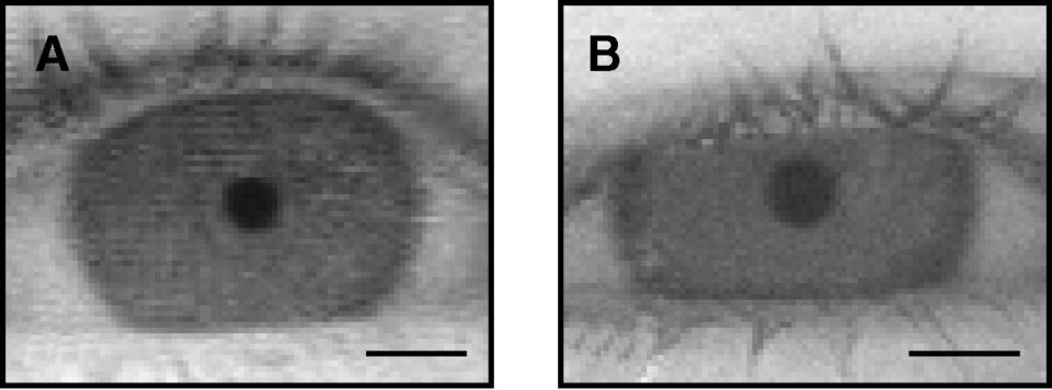 The pupil of a Moken child (A), smaller than that of a European child (B), promotes better underwate