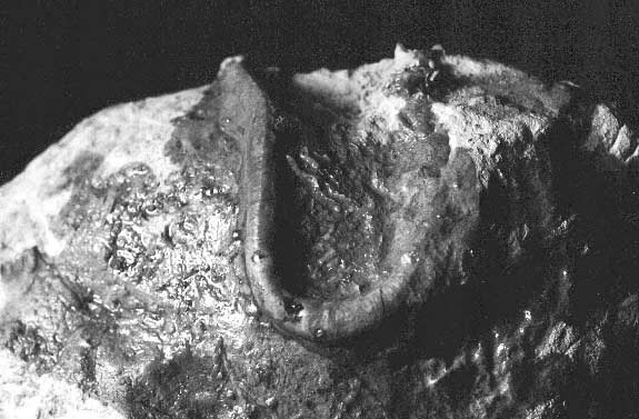 A Fossilized Human Finger