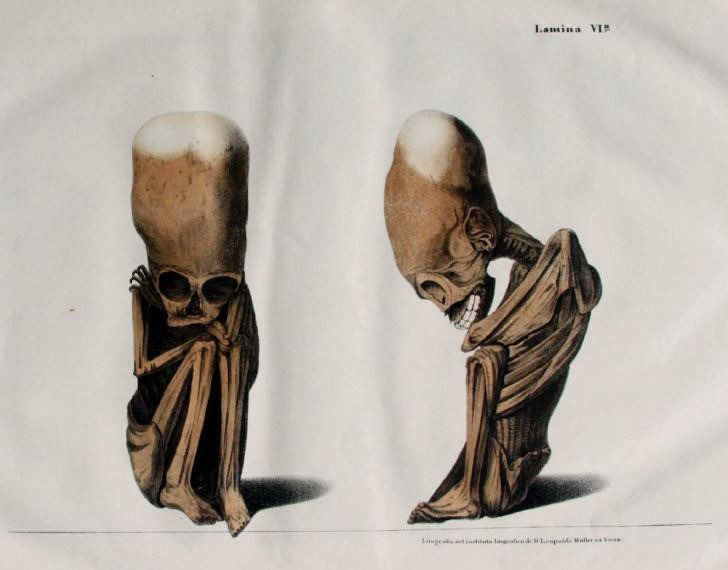 Elongated skulls, without cranial deformation