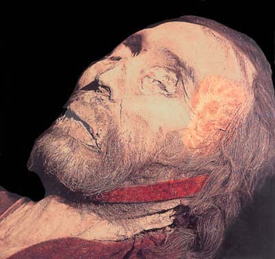 A a perfectly preserved man with very white skin and reddish hair. This is a man who died around 100