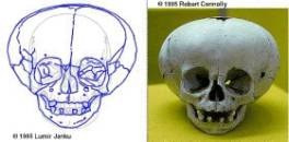 Figure 2 left: one of the skulls found by Shapiro and preserved at the Archaeological Museum in Lima