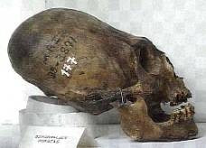 Figure 1: a clear example of cranial elongation in a skull found in Paracas