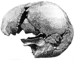 The Castenedolo skull