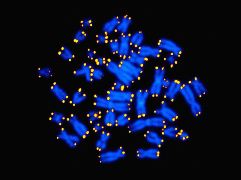 Human chromosomes with telomeres highlighted in yellow.